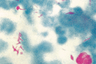 한센균 현미경 확대 사진